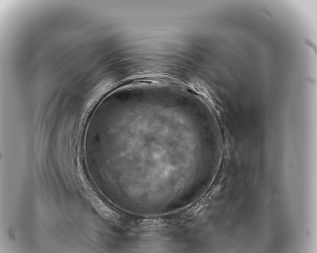 X0000096220145200801251104