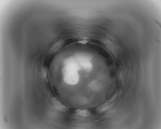 X0000096220185200801251105