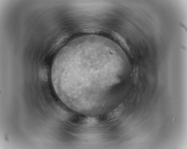 X0000096220114200802011351