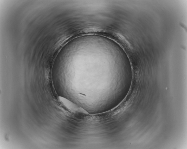 X0000096221217200802011335