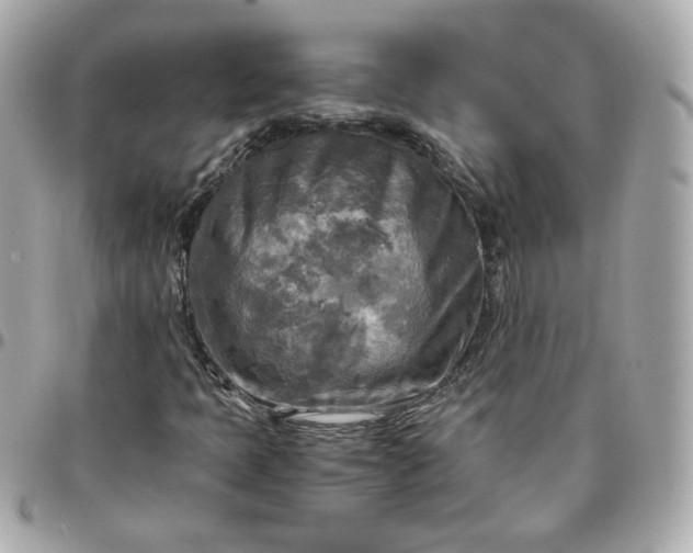 X0000096221397200802011332