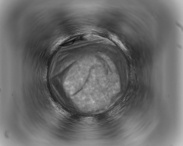 X0000096220058200802081535