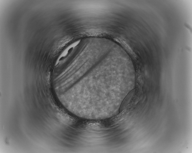 X0000096220066200802081535