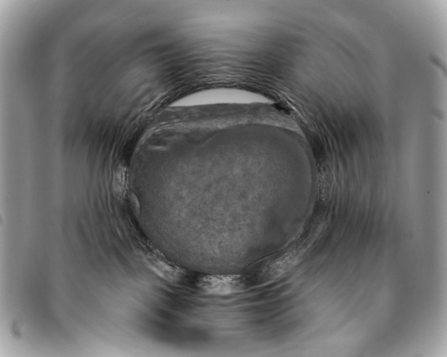 X0000096220093200802081535