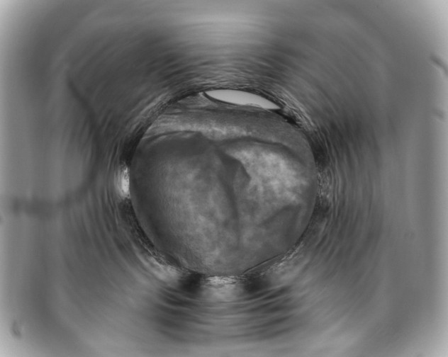 X0000096220095200802081535