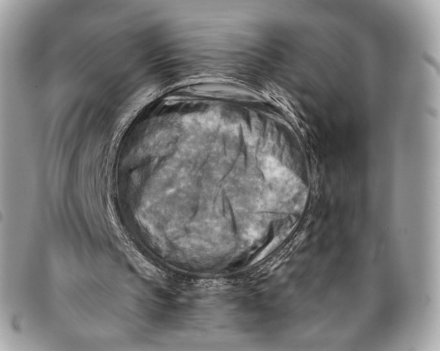 X0000096220145200802081533