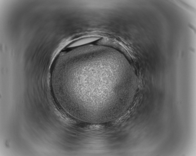 X0000096220152200802081533