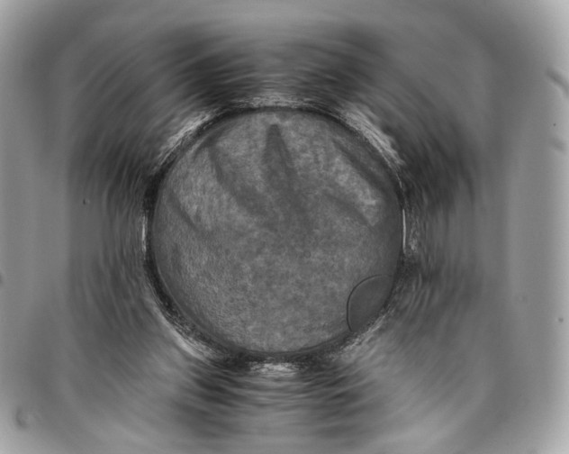 X0000096220157200802081533