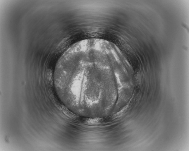 X0000096220178200802081533