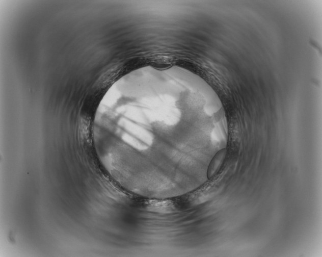 X0000096220185200802081533