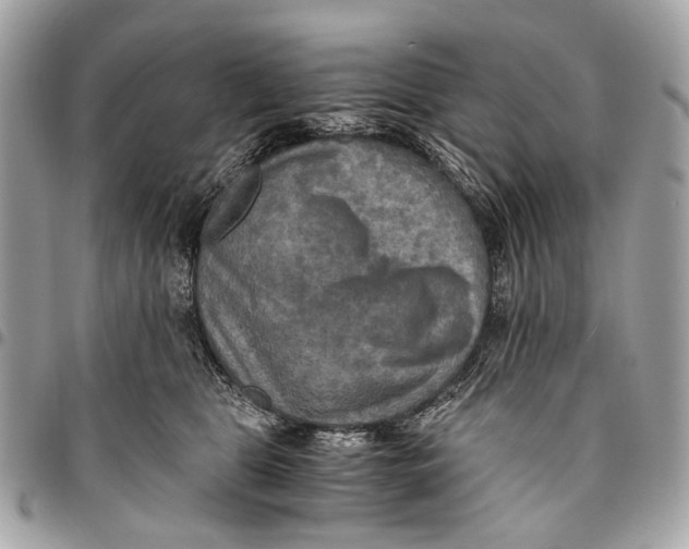 X0000096220469200802081529