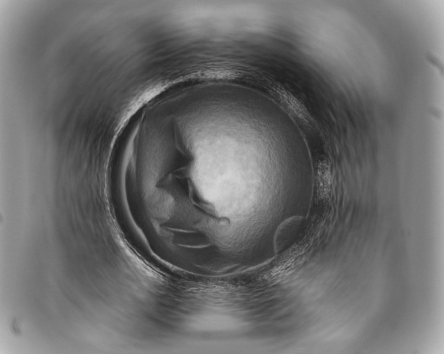 X0000096220726200802081524