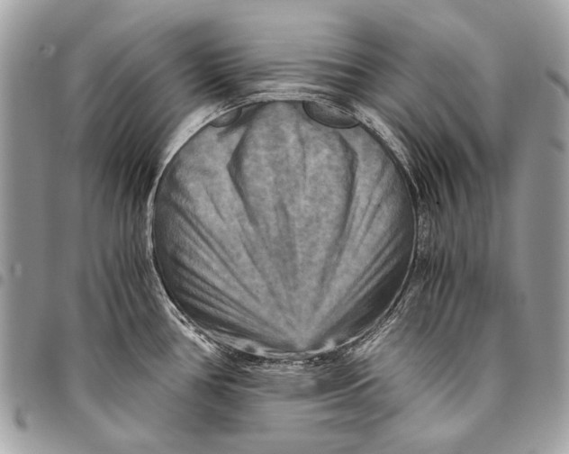 X0000096221386200802081515