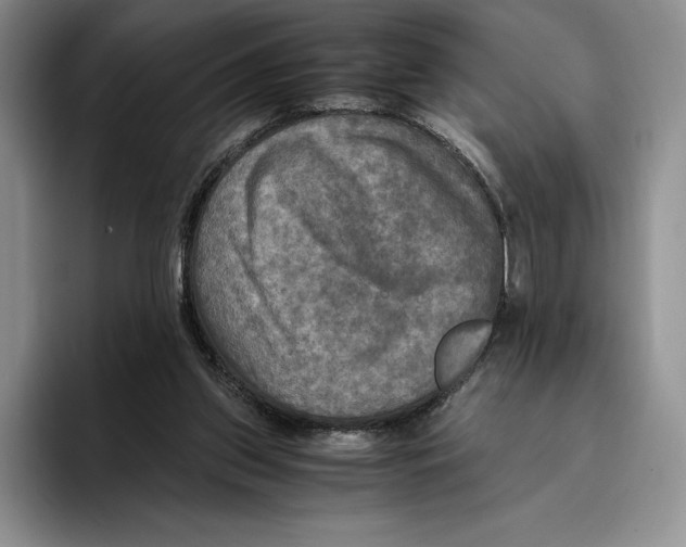 X0000096220157200802151529