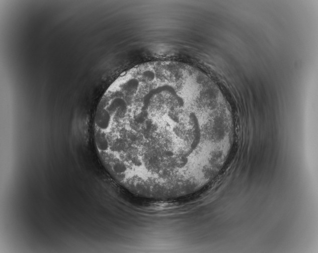 X0000096220319200802151527