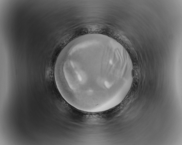 X0000096220419200802151526