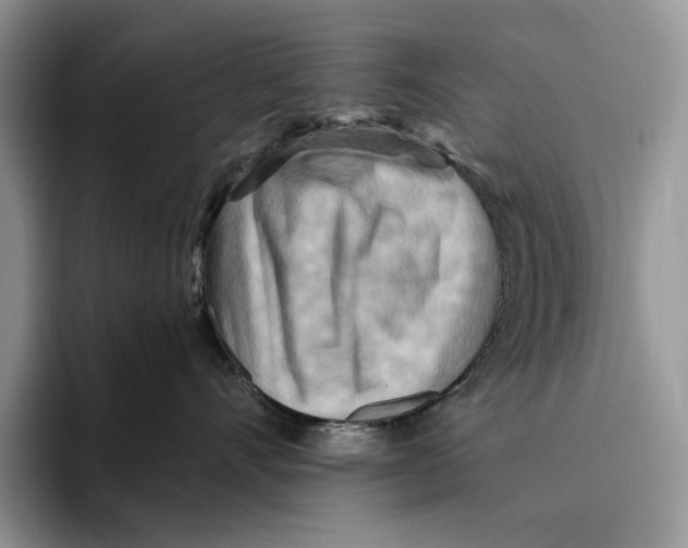 X0000096220528200802151524