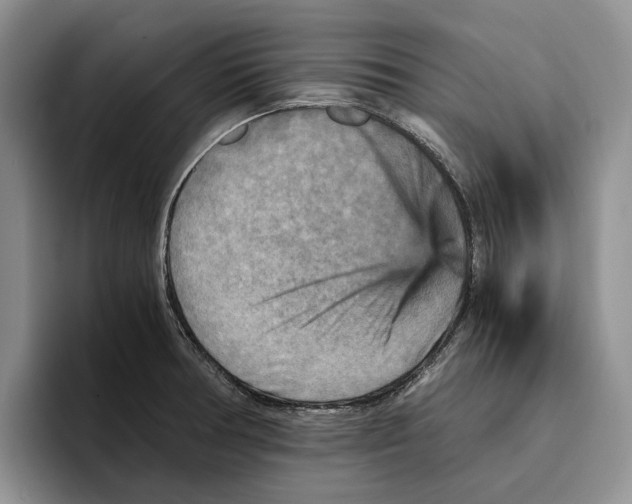 X0000096221378200802151513