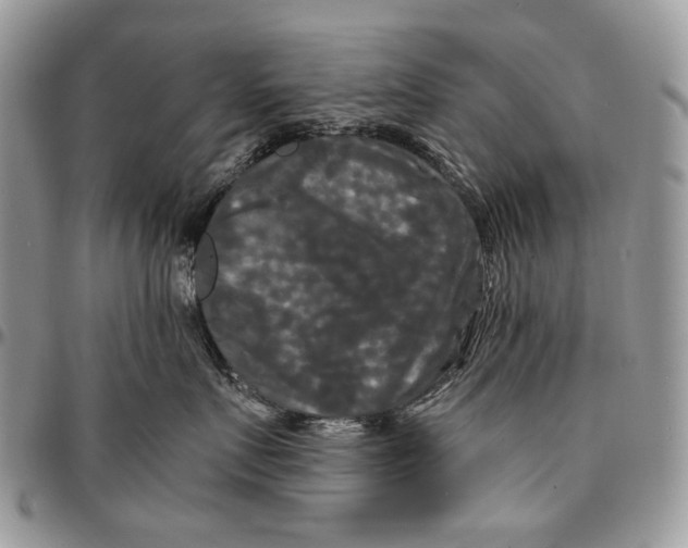 X0000096380719200802141431