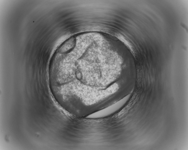 X0000096381088200802141425