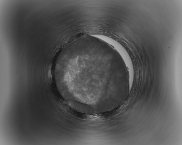 X0000096380516200802211124