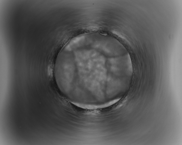 X0000096380576200802211124