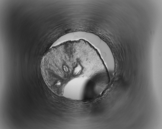 X0000096381059200802211117