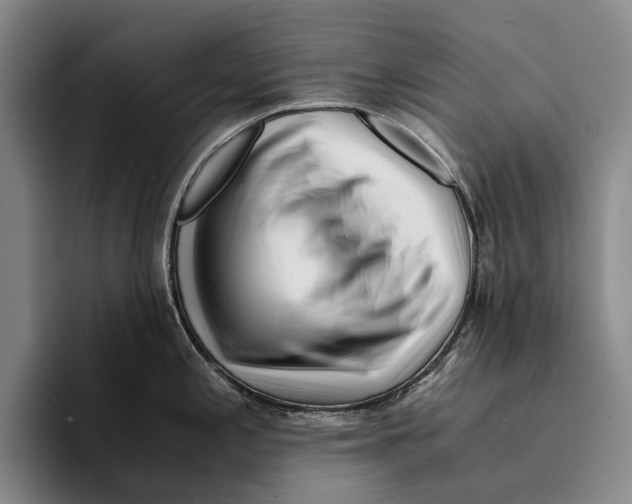 X0000096381197200802211115