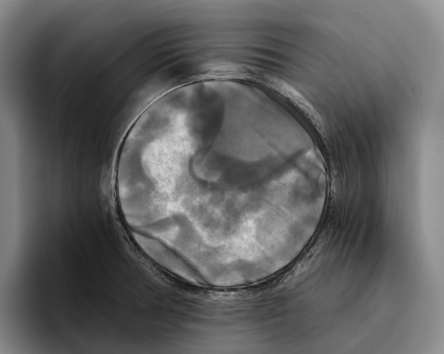 X0000096381378200802211112