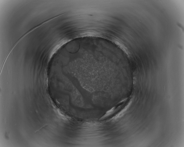 X0000096391117200801311315