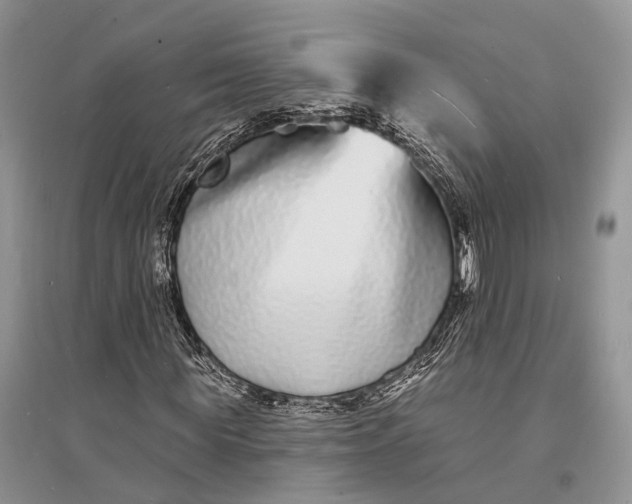X0000096390819200802071535