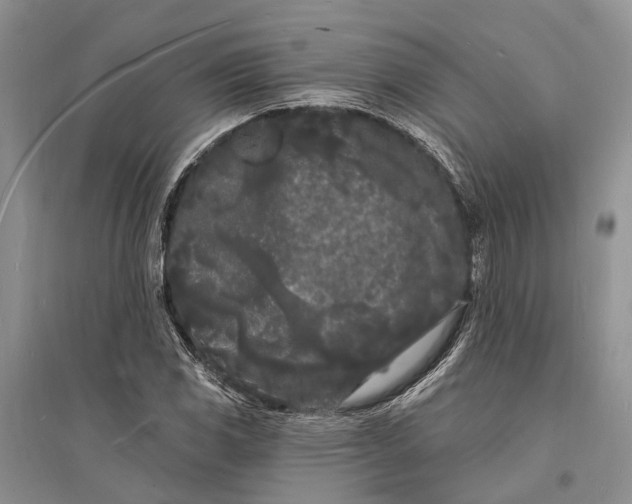 X0000096391117200802071530