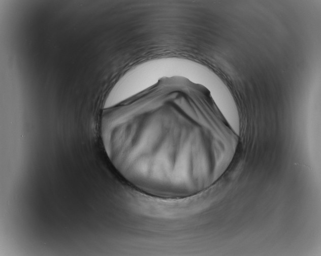 X0000096390039200802211151