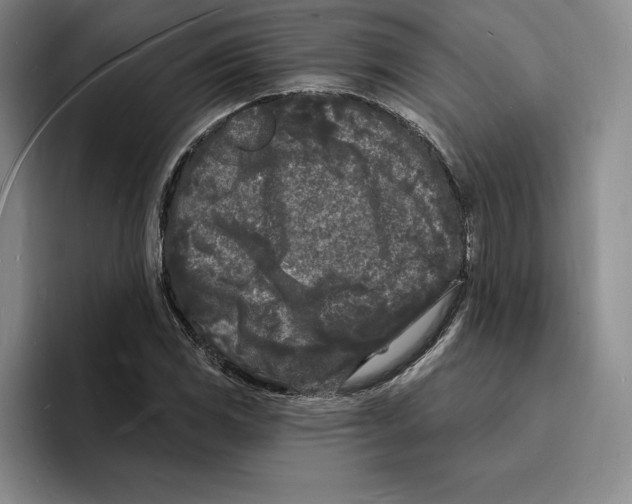 X0000096391117200802211136