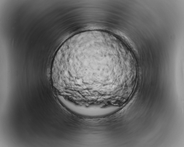 X0000096391185200802211135