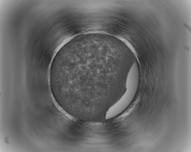 X0000096400957200802141515