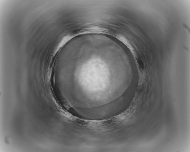 X0000096401477200802141507