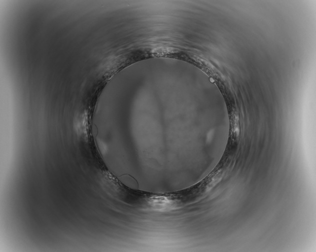 X0000096410519200801241223