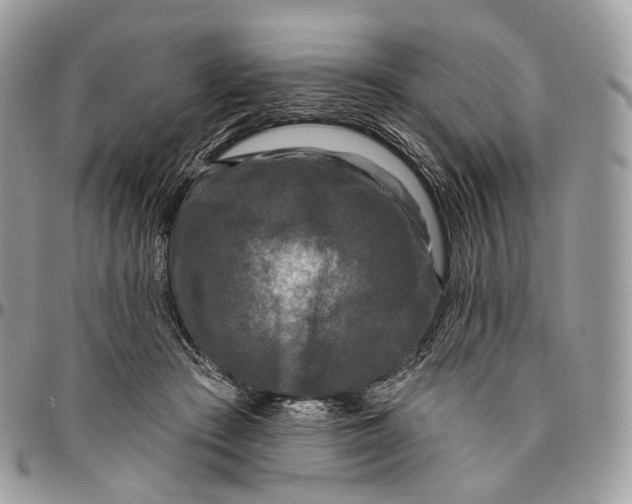 X0000096410409200802141545