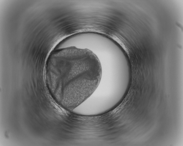 X0000096411076200802141536