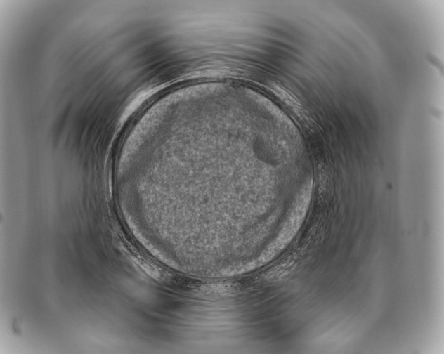 X0000096411078200802141536