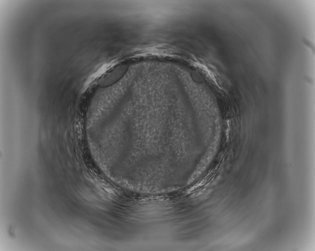 X0000096411159200802141534