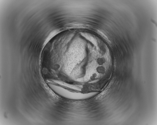 X0000096411378200802141531