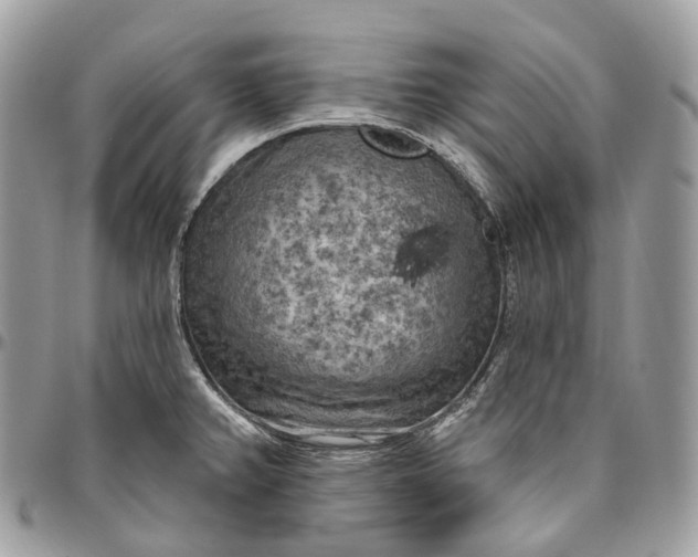 X0000096411382200802141531