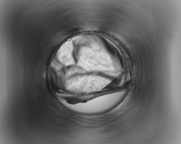 X0000096411257200802211217