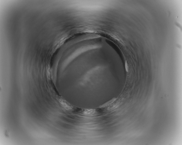 X0000096420720200801241317