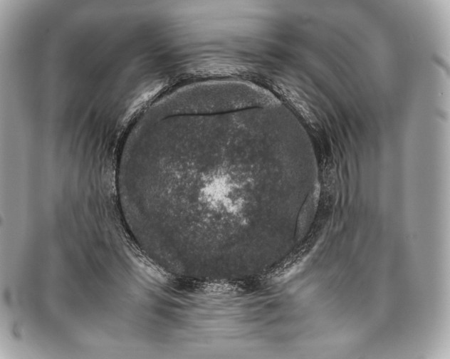 X0000096420399200802071707