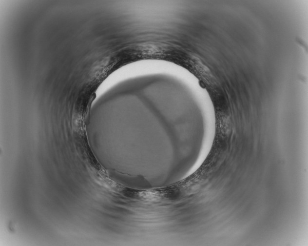 X0000096420419200802071707