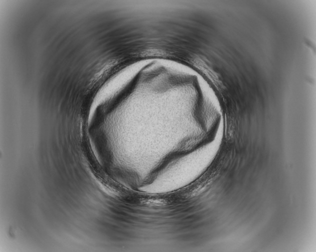 X0000096420157200802141642