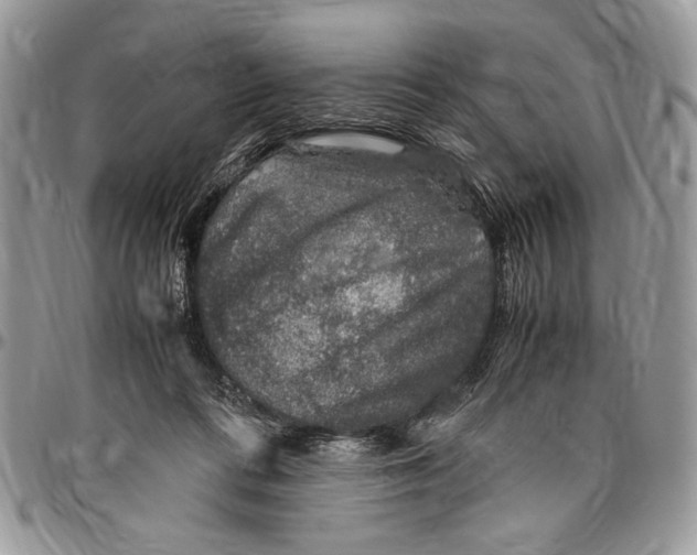 X0000096420312200802141640